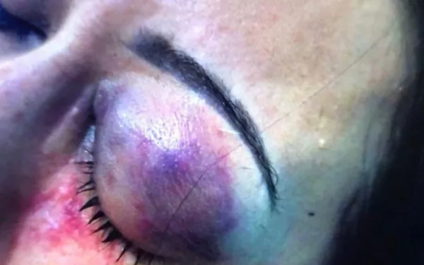 Mulher é agredida por esposa e filha de vereador em Guaíra
