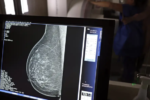 Planos de saúde terão que ampliar cobertura de mamografia digital